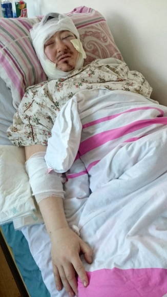 Кадыр Маликов в больнице