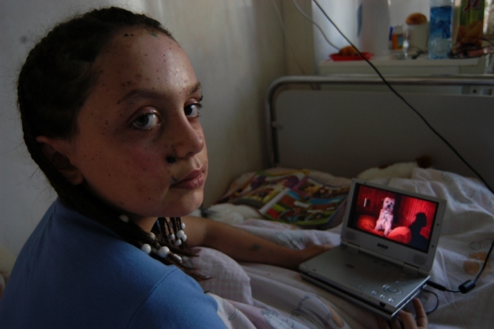 Дзерасса Будаева, 9 горбольница, принявшая часть пострадавших в Беслане детей. Москва, 2004.  